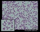 Haemophilus influenzae micrograph